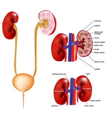 neprology1